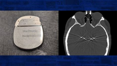 Image result for Brain-Stimulating Machine