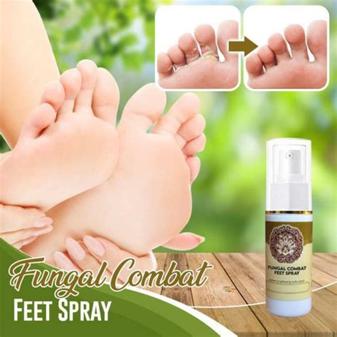 Buy Women Men Spray Fungus Combat Feet Anti Fungal Infections Athlete's ...