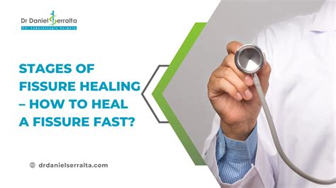 Rectal Prolapse Vs Hemorrhoids – What Is The Main Difference? - Dr ...