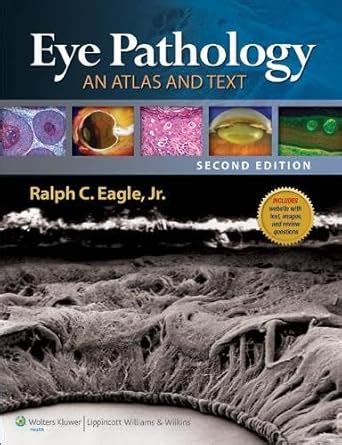 Buy Eye Pathology: An Atlas and Text Book Online at Low Prices in India ...