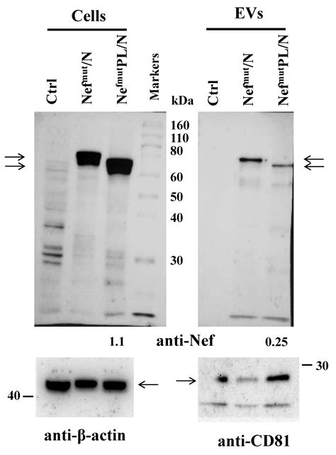 Activation of Anti-SARS-CoV-2 Human CTLs by Extracellular Vesicles ...