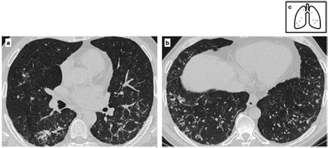 Tomography | An Open Access Journal from MDPI