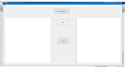 Image result for Brain Tumor Detection Using MATLAB