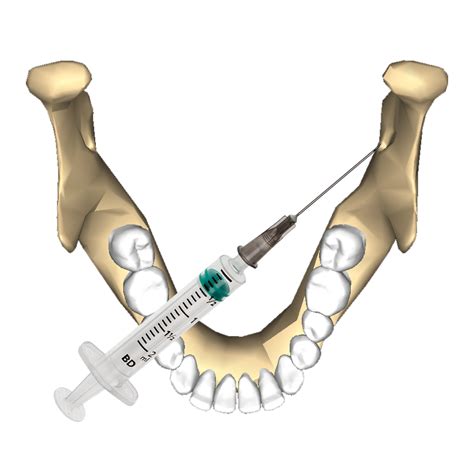 2 things I wish I knew 8 years ago while administering Inferior ...