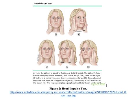 emDOCs.net – Emergency Medicine EducationPosterior Circulation Strokes ...