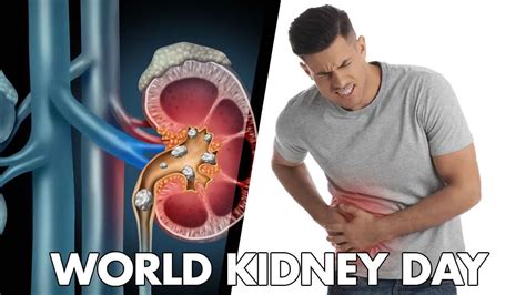 World Kidney Day 2025: Check Theme, History And Its Significance ...