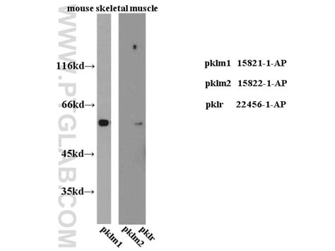 PKLR antibody (22456-1-AP) | Proteintech