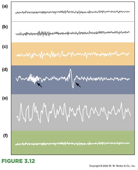 Sleep 的图像结果