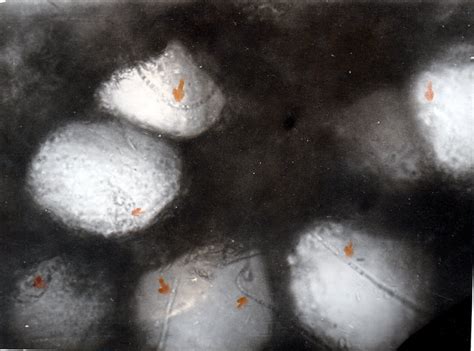 Image result for Cherry Tree Root System