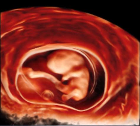 drayushdiagnostics | AYUSH ULTRASOUND & DIAGNOSTICS