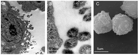 Tumor Cell-Derived Microvesicles Induced Not Epithelial-Mesenchymal ...