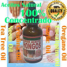 Nail Fungus, Hongos de unas, Anti Hongos, Hongos de | Ubuy India