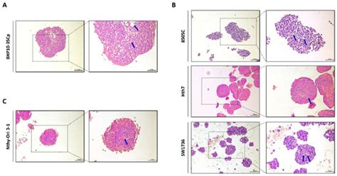 Different Expression of Thyroid-Specific Proteins in Thyroid Cancer ...