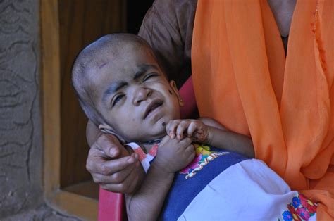 SC orders Kerala to compensate Endosulfan victims in 90 days