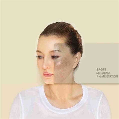 Black Spots On Antique Furniture at Leonard Cone blog