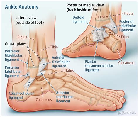 Ankle Sprains in Youth | Sports Medicine | JAMA Pediatrics | JAMA Network