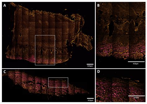 Visualization of Keratin with Diffuse Reflectance and Autofluorescence ...