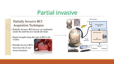 Brain Computer Interface 的图像结果
