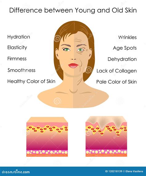 The Difference between Young and Old Skin, Vector Illustration Stock Vector - Illustration of ...