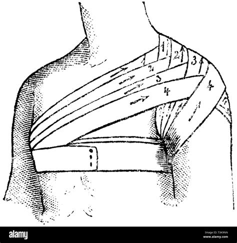 How To Bandage A Shoulder For Support at Ava Willson blog
