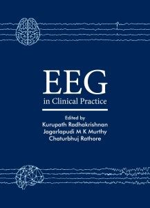 EEG in Clinical Practice: Buy EEG in Clinical Practice by Kurupath ...