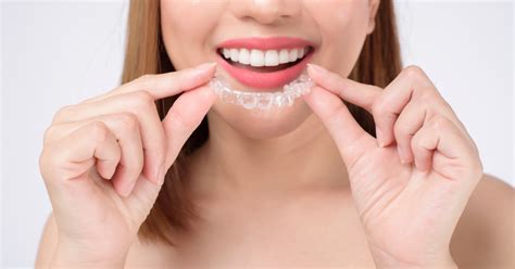 Invisalign Tips 的图像结果