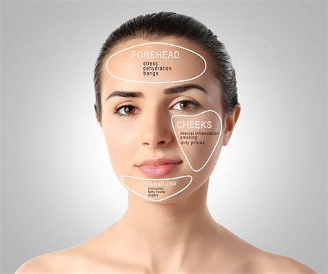 Comprendre Son Acné Avec Le Face-Mapping – PTJCCV