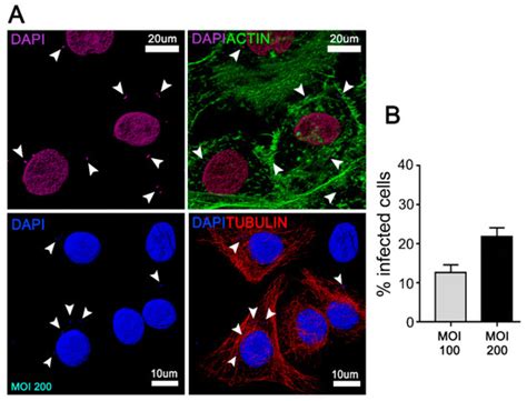 Cells | Special Issue : Autophagy in Antimicrobial Immunity