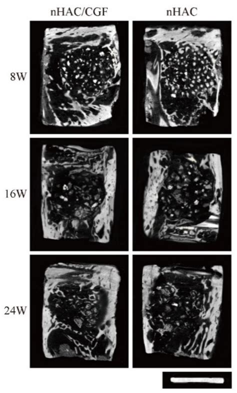 The Ability and Mechanism of nHAC/CGF in Promoting Osteogenesis and ...