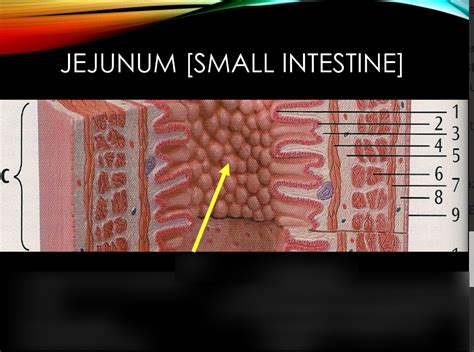 Image result for Small Intestine Jejunum