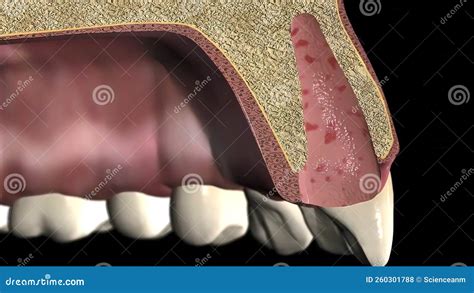 Image result for Tooth Extraction Side Profile