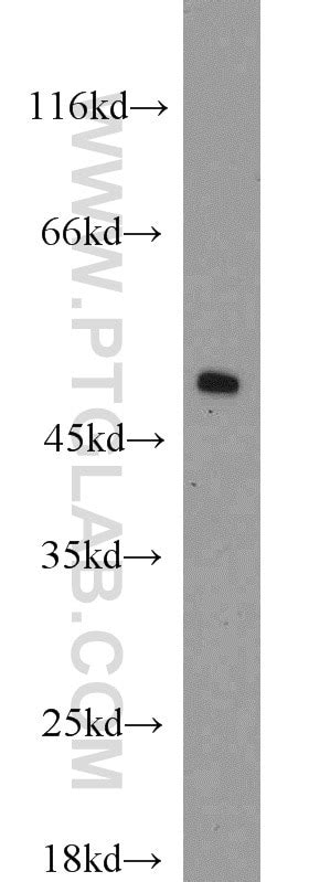 EEF1A1 antibody (11402-1-AP) | Proteintech