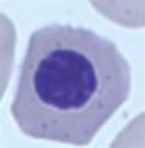 Nucleated Red Blood Cells