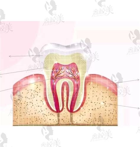 牙髓炎，可以自愈吗?作为一名重度牙髓炎患者的自述。_荔枝美