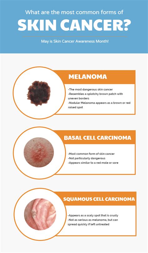 Image result for How Skin Cancer Forms