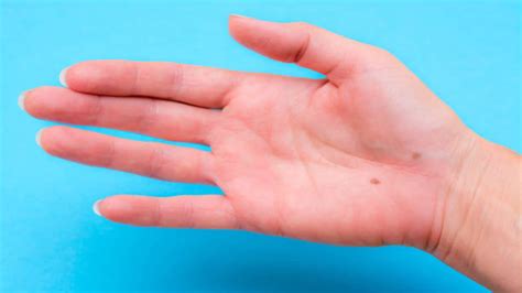 Mole On Palm:हथेली पर मौजूद हर तिल होता है खास, जानें क्या कहता है ...