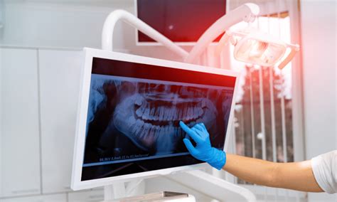 Oral Surgery - Botanikx Clinic