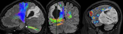 Image result for fMRI Python