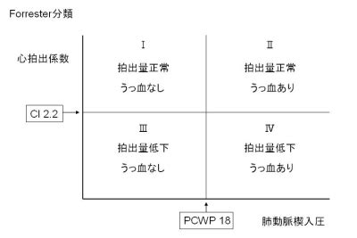 Image result for Stack Layout Display