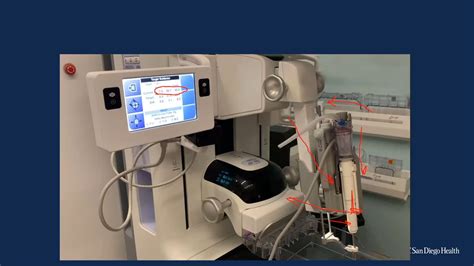 Stereotactic Biopsy Using Digital Breast Tomosynthesis | ELS
