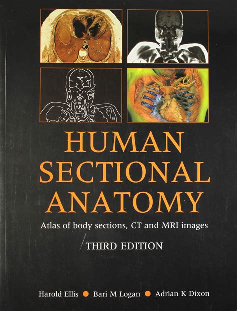 (OLD)HUMAN SECTIONAL ANATOMY ATLAS OF BODY SECTIONS, CT AND MRI IMAGES ...