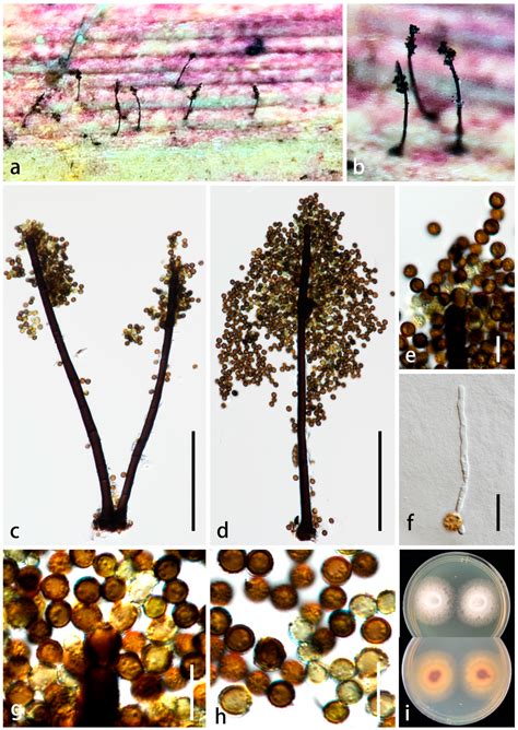 Three New Periconia Species Isolated from Wurfbainia villosa in ...