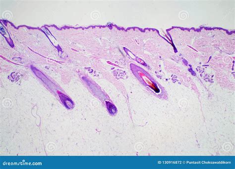 Histology Of Skin Stained With H&E Stock Photography | CartoonDealer ...