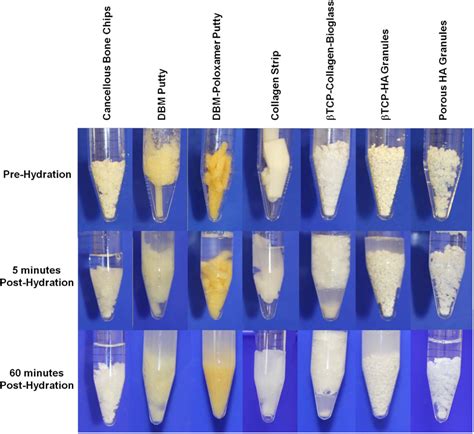 Short Term Culture of Human Mesenchymal Stem Cells with Commercial ...