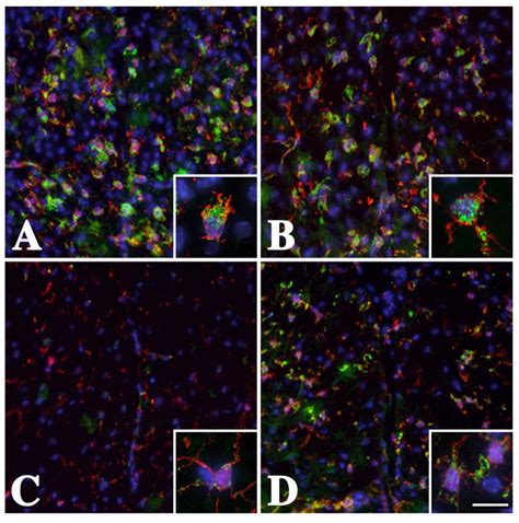 Brain Sciences | Special Issue : Myelin Repair