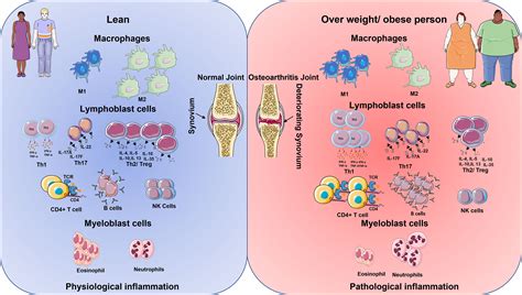 Frontiers | Obesity, Inflammation, and Immune System in Osteoarthritis