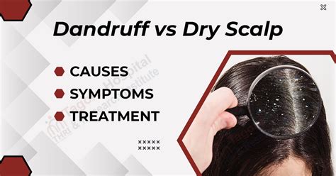 Scalp Dandruff 的图像结果