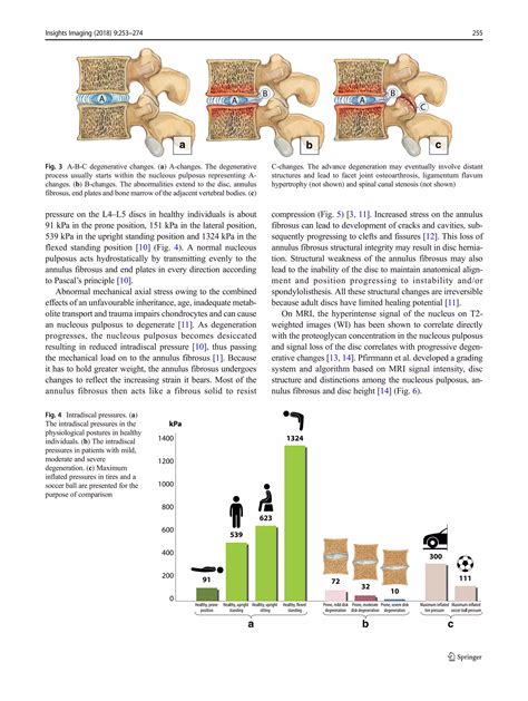 Abcs of the degenerative spine | PDF