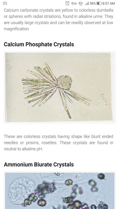 Calcium Phosphate Crystals In Urine