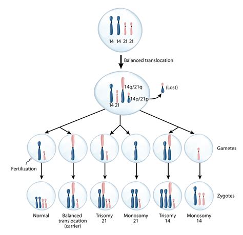 Translocation Down Syndrome Diagram